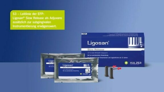 Kulzer Ligosan Slow Release | adjuvante PA-Therapie | 146774