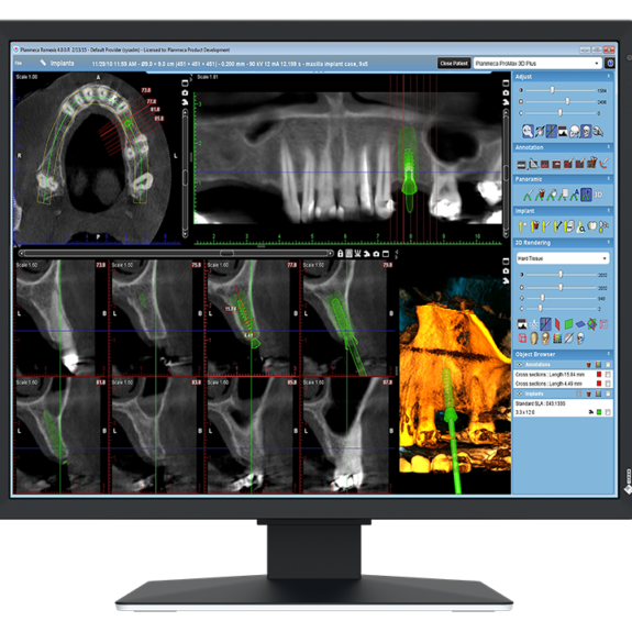 EIZO MX217-HB Befundungsmonitor Dental | 202586