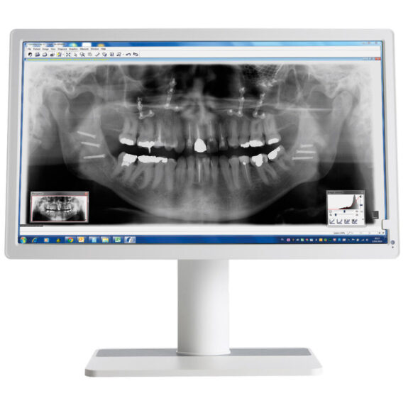 Barco Nio MDNC-2123 2MP 23,6″ Dental Befundungsmonitor | 244503